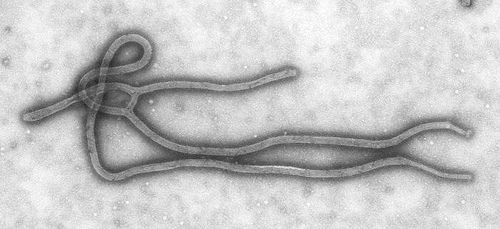 エボラ出血熱患者の携帯を盗み、自分もウイルスに感染